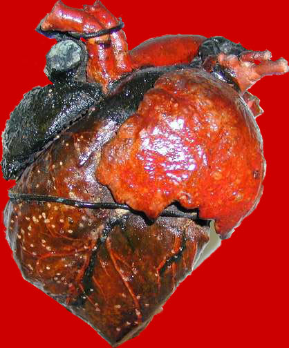 che cosa ti aspettavi da quel bastardo del cuore?